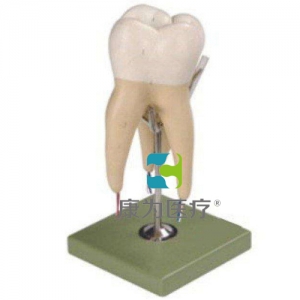 “康為醫療”磨牙有三個牙根模型